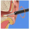 Earwax Removal Kit – Smart Visual Earwax Removal Tool&nbsp;👂📱
