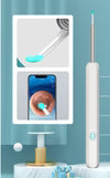 Earwax Removal Kit – Smart Visual Earwax Removal Tool&nbsp;👂📱